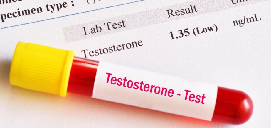 vial from testosterone test
